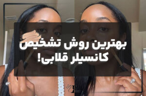 بهترین روش تشخیص کانسیلر قلابی