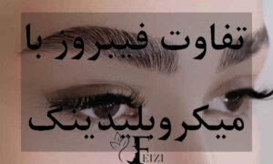 تفاوت فیبروز با میکروبلیدینگ