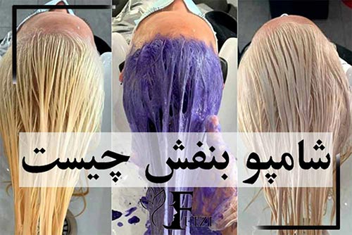 شامپو بنفش چیست